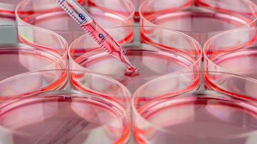 [SK-25CELL-135] Human Peripheral Blood Lymphocytes